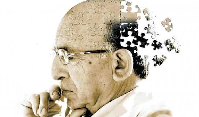 Alzheimer, possibile relazione tra accumulo di ferro e declino cognitivo