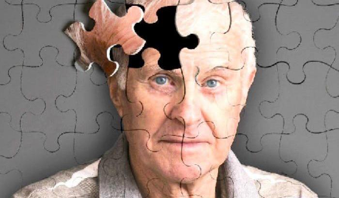 Individuato uno dei meccanismi alla base della malattia di Alzheimer